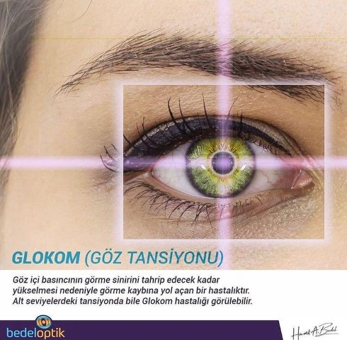 Hamit Bedel Optik